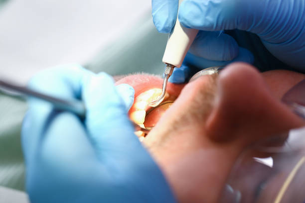 Best Tooth Infection Emergency Dentist  in Mequon, WI