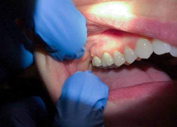 Best Emergency Gum Pain Relief  in Mequon, WI